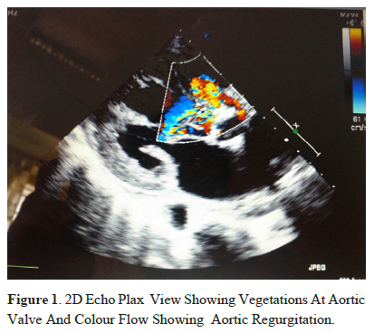 2D Echo Plax View Showing