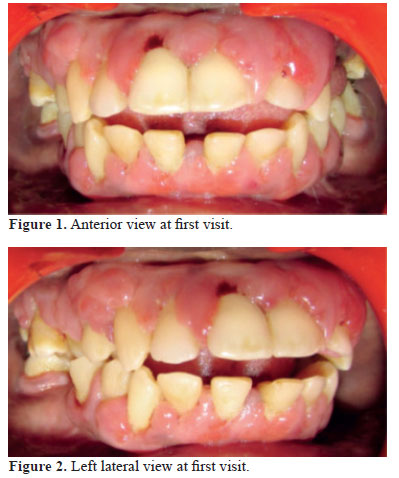 anterior view